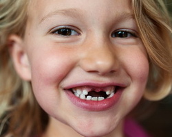 Как меняются зубы у детей последовательность