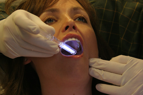 Онкологический скрининг в стоматологии